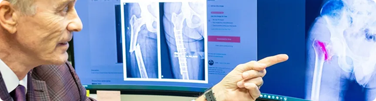 Orthopedic physician reviewing X-ray images for independent medical exam evaluation